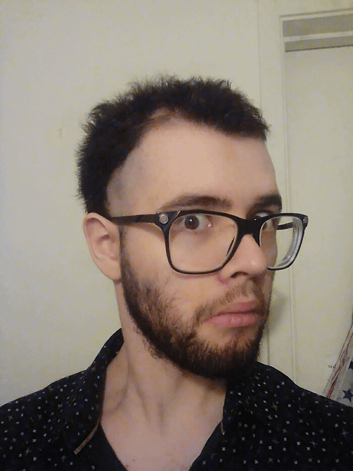 A man with a bad hair day, sporting a messy haircut and thick-rimmed glasses, looking surprised.