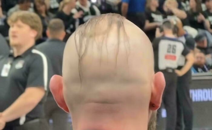 A person with a bad hair day, featuring a visible bald patch and thin, stringy hair from behind.