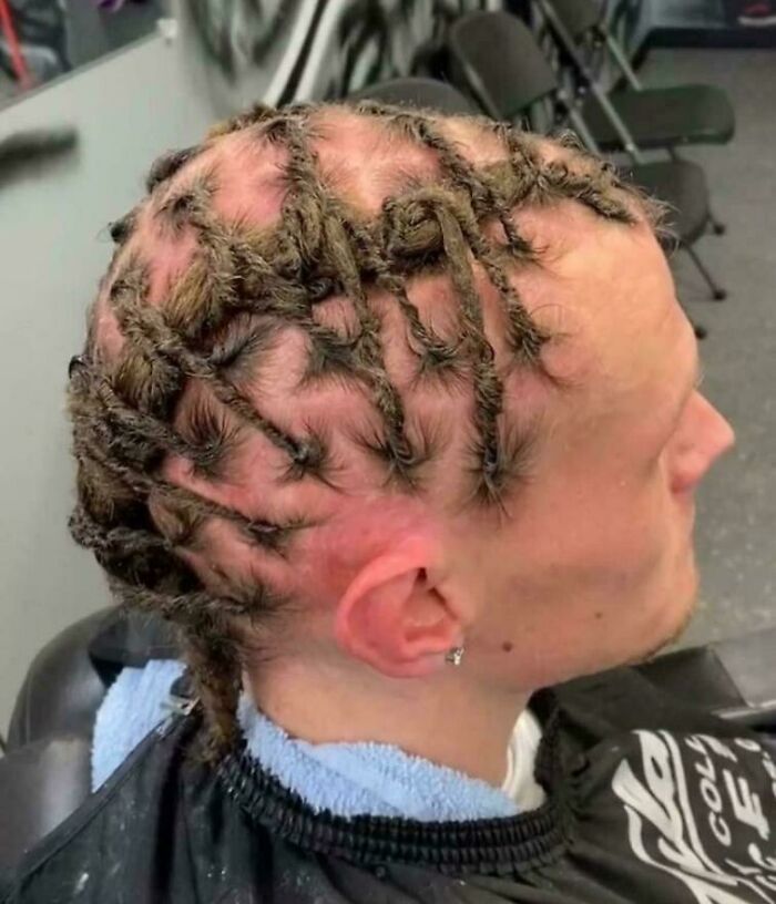 A man with a bad hair day, showing braided, dreadlock-like hair on a mostly bald scalp.
