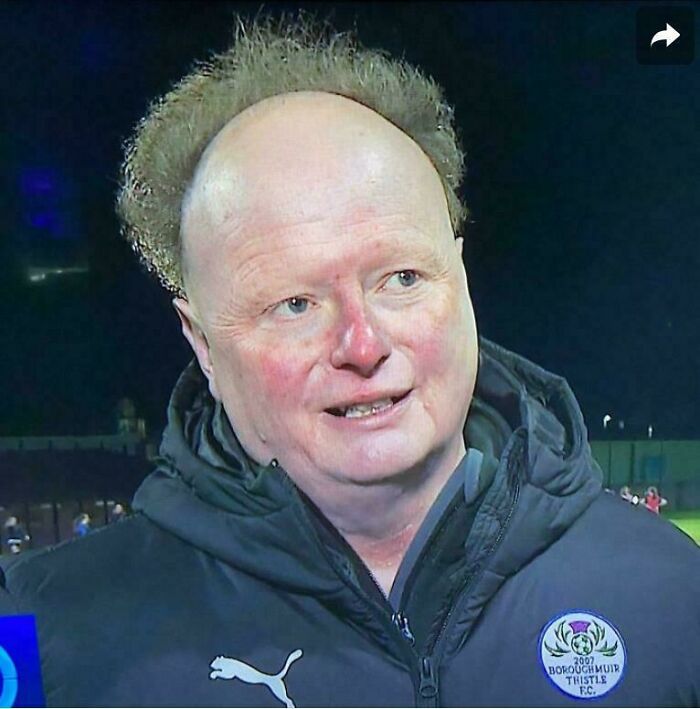 A balding man with a bad hair day, curly hair around the sides of his head, is shown wearing a sports jacket.
