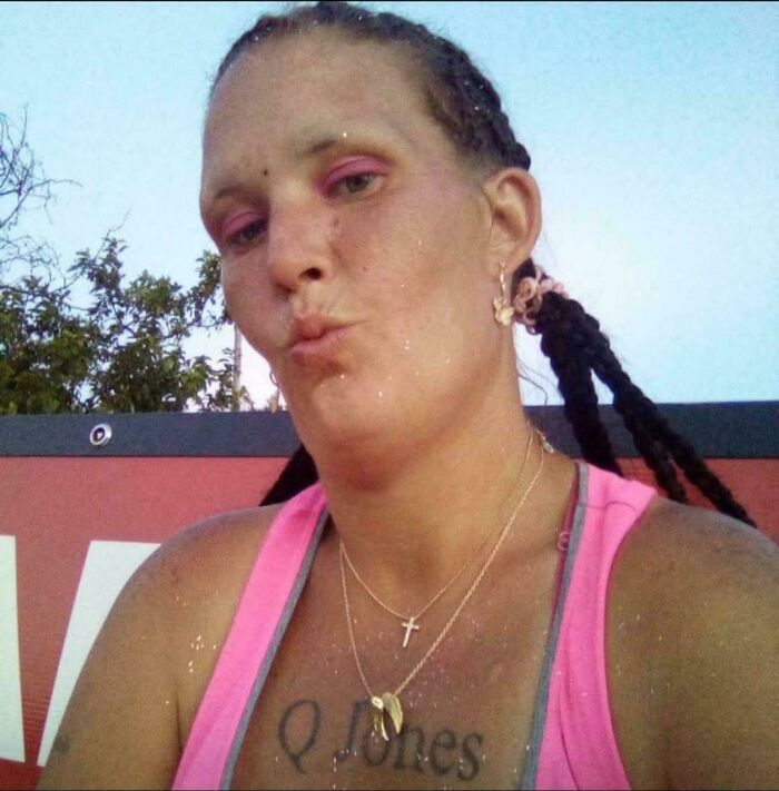 Woman with cornrows and a puffy face, an example of a bad hair day.