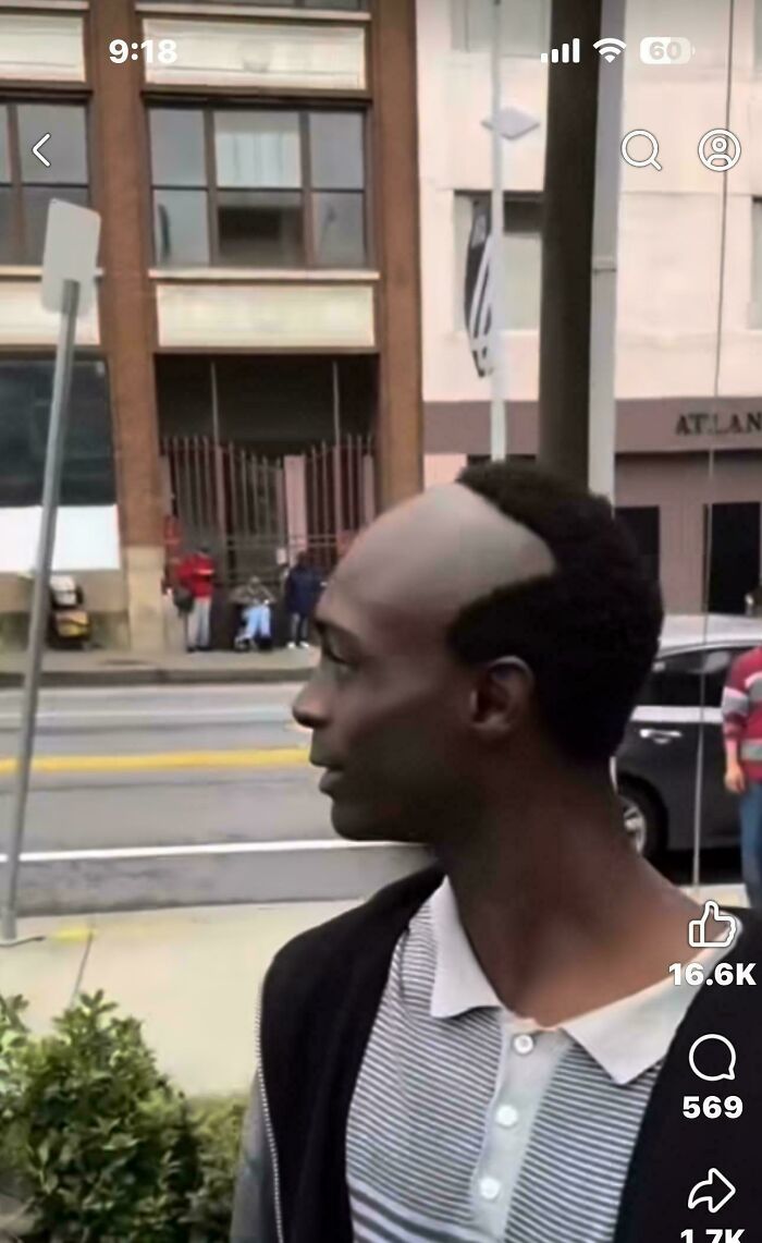 A man with a funny bad hair day haircut, shaved bald on top with a thick dark hairline.