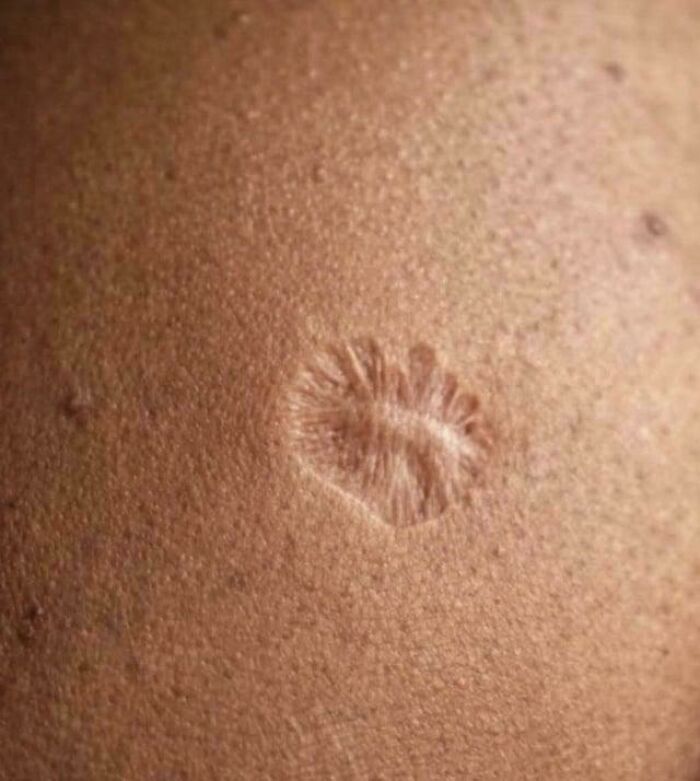 A close-up of interesting skin texture, showing a unique pattern that got people saying 'D**n, That’s Interesting'