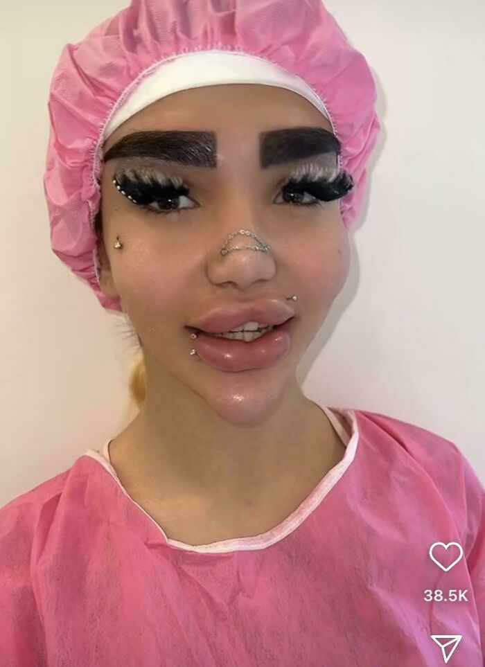 A person with extreme lip and brow fillers, wearing a pink cap and gown, after a beauty salon visit.
