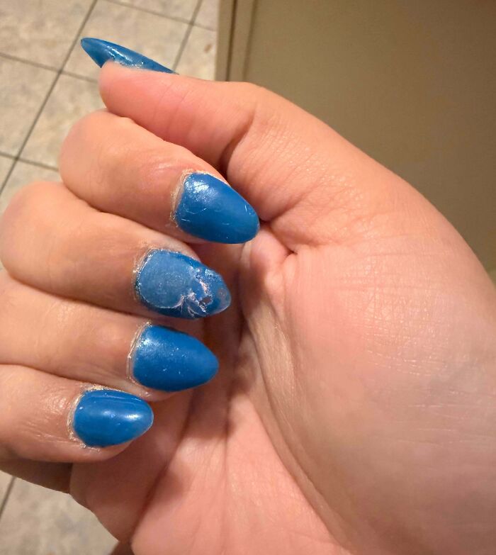 A hand with poorly done, chipped blue acrylic nails, showcasing a bad beauty salon nail job.