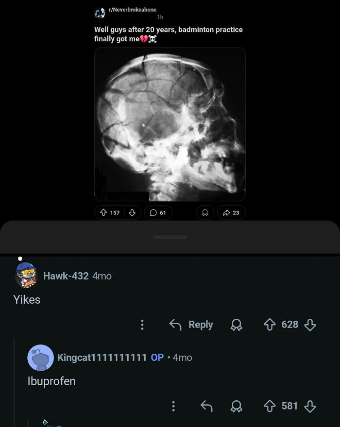 X-ray of skull humor with badminton injury joke from social media comments