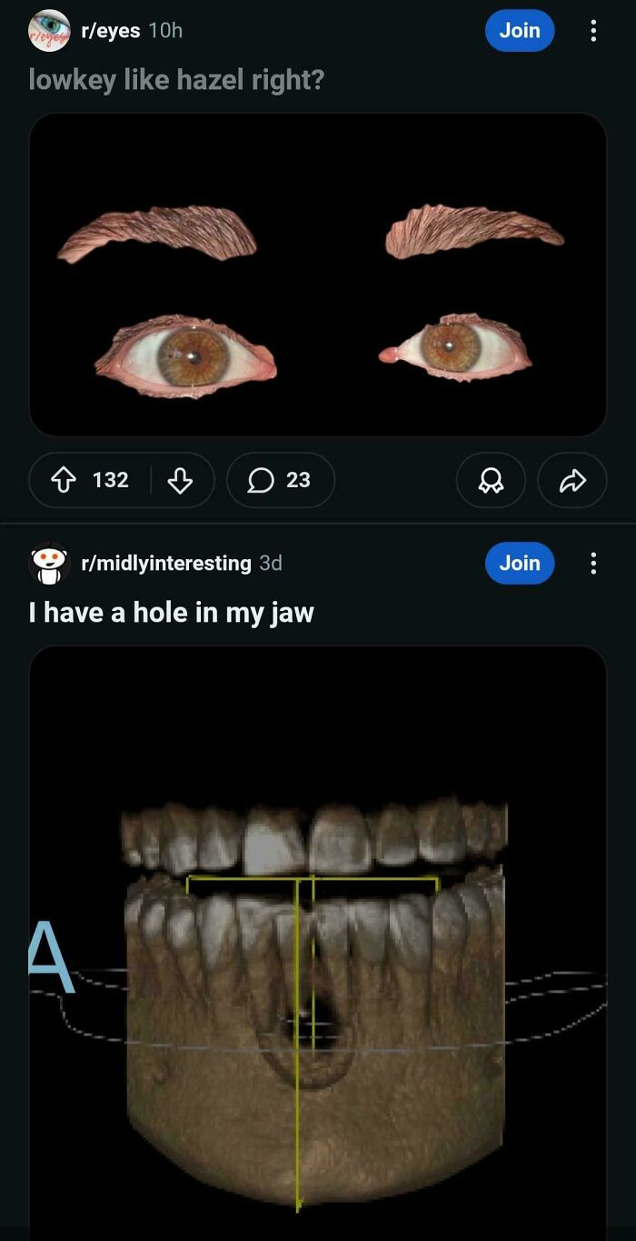 A screenshot compiling two weird internet moments: one about hazel eyes and another showing a 3D scan of a jaw with a hole.