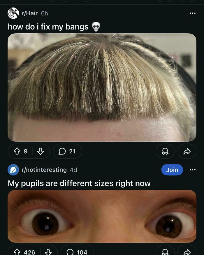 A close-up of bangs that need fixing and a person's eyes with different sized pupils, from the Not Interesting community.