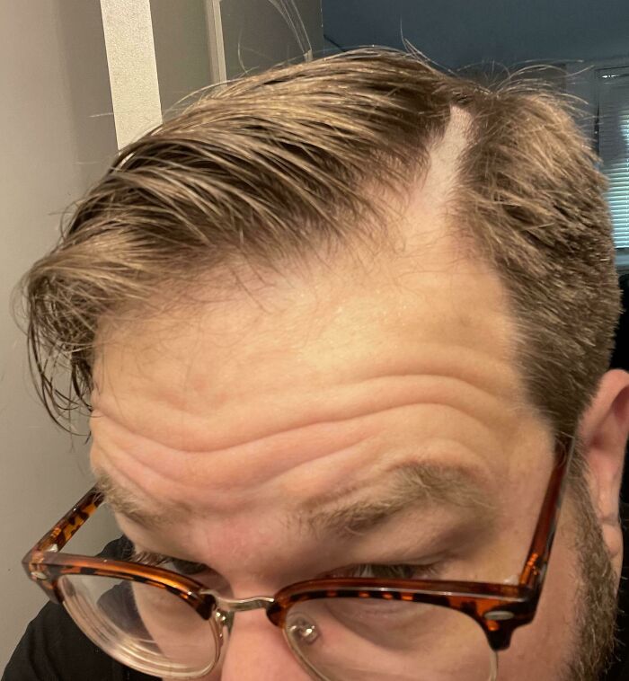 A man with an uneven hair part, illustrating a hair salon disaster.