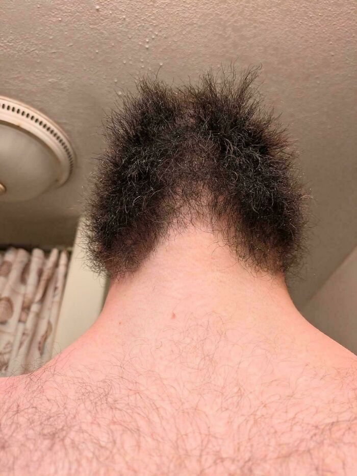 Hair Salon Disasters: The back of a person's neck with very uneven, poorly trimmed hair, illustrating a hair disaster.