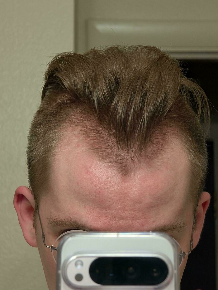 A man with a visibly receding hairline at a hair salon, showcasing a hair salon disaster.