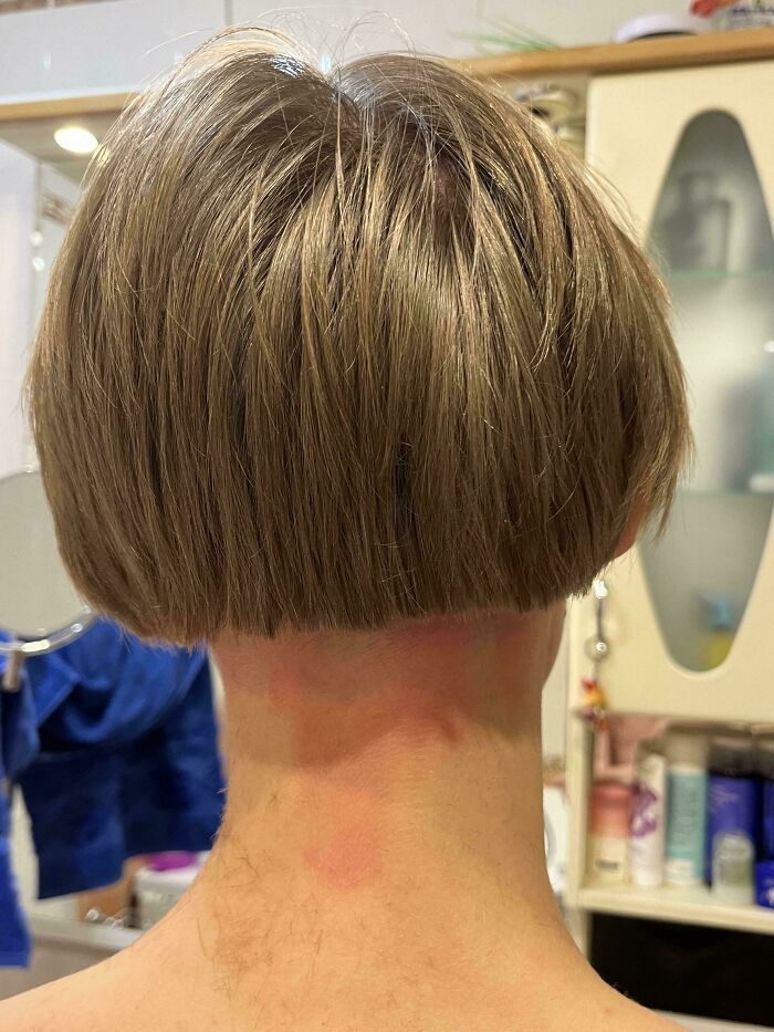 The back of a head with a hair salon disaster, showing a very short, poorly cut bob with an uneven hairline.