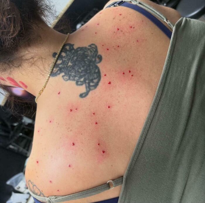 Tattoo fail showing red irritated skin with a messy black tattoo