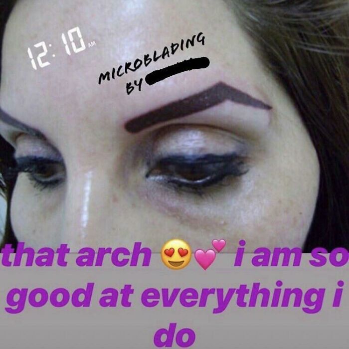A close-up of a woman's face with poorly microbladed eyebrows that are thick, dark, and uneven, from a beauty salon.