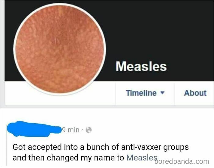 A Facebook profile, for a mad lad, named Measles, with a profile picture showing skin with a rash.
