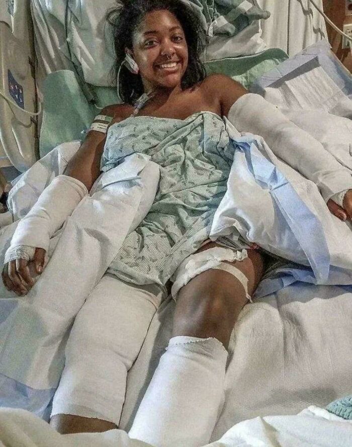 She Took 40 Bites To Save A Baby’s Life