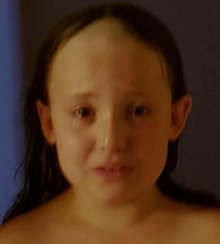 Young girl with an unfortunate haircut, showing a receding hairline and crying.