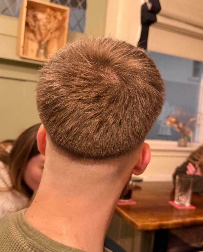 The back of a man's head features a bowl-cut style, one of many unfortunate haircuts.