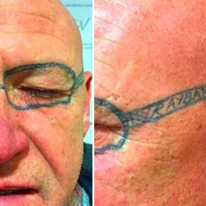 Tattoo of eyeglasses drawn around eyes on bald head