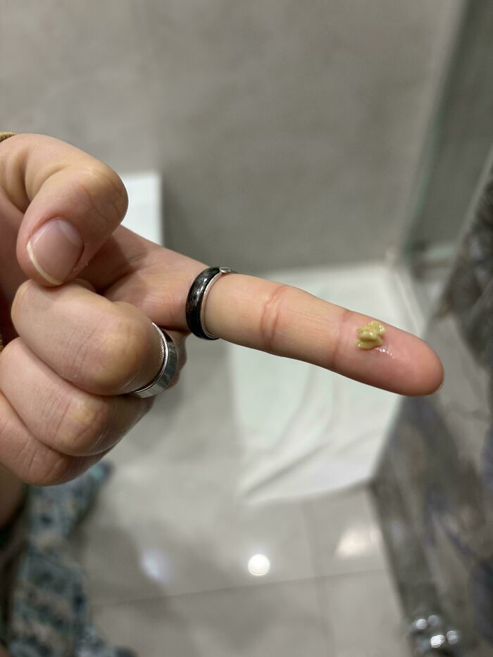 A finger with rings on it holding a small, yellowish, irregular-shaped object. Things that should really be left alone.