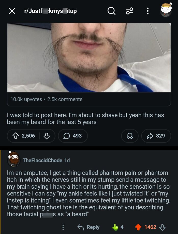 A social media post about hilarious burns, featuring a man with an unusual beard and a comment about phantom pain.