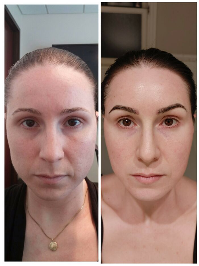 Before and after image of someone who left everyone speechless at reunions.