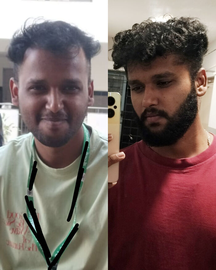 A man's before and after photos showcase a dramatic change in appearance, shocking people at reunions.