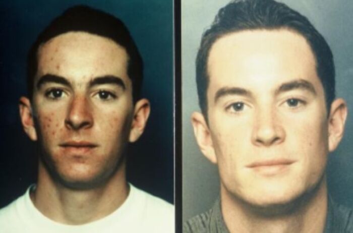 A man's before-and-after photo, showcasing a remarkable transformation, leaving everyone speechless at reunions.