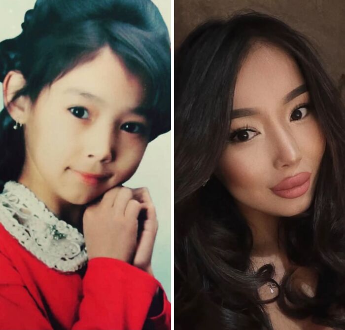 Before and after photo of a woman showing her incredible transformation from an ugly duckling to an adult.