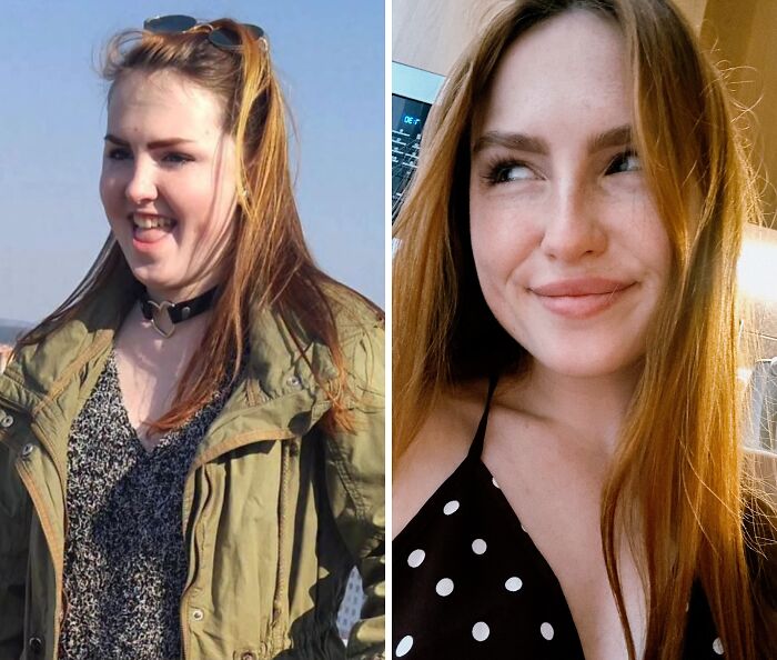 Before and after photo of a woman showing her incredible transformation from an ugly duckling to an adult.