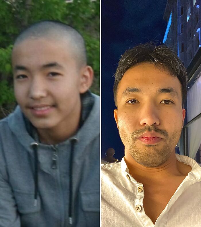 Before and after photo of a man showing his incredible transformation from an ugly duckling to an adult.