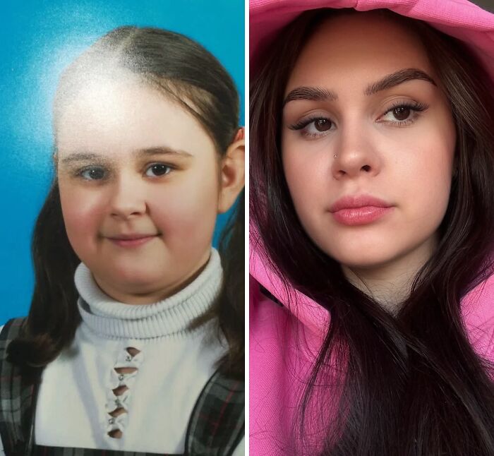 Ugly duckling transformation, a young girl embracing her beauty and self-love.