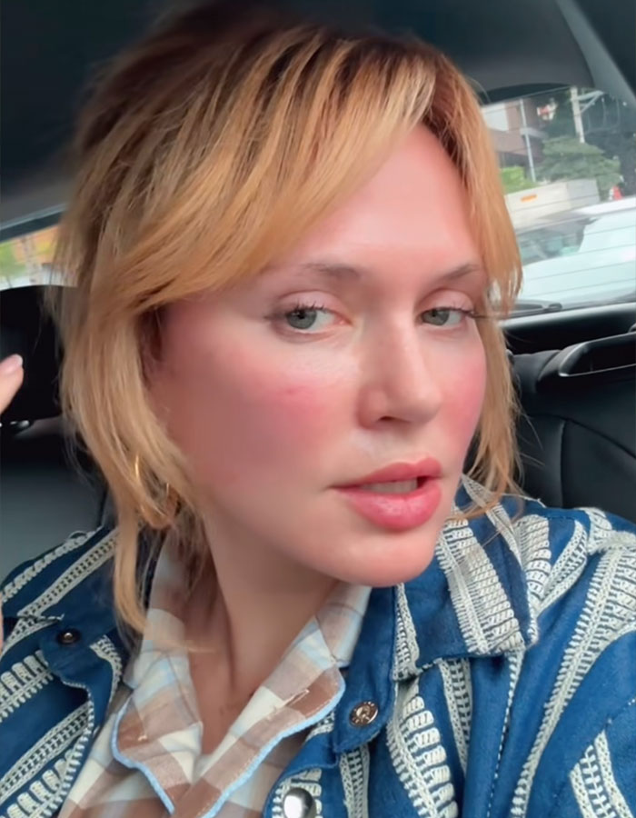 Close-up of US influencer showing facial changes after plastic surgery in car Close-up of US influencer showing facial changes after plastic surgery in car