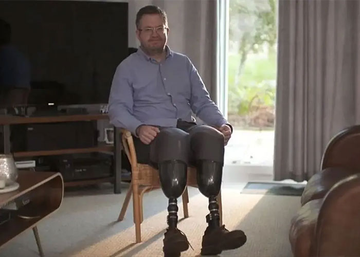 Man with prosthetic legs sitting in a living room illustrating professional surgeon story Man with prosthetic legs sitting in a living room illustrating professional surgeon story