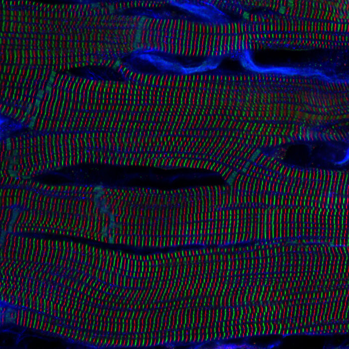 “Sarcomere Structures Within Cardiomyocytes In A Rat Heart” By Kentauro Mochizuki