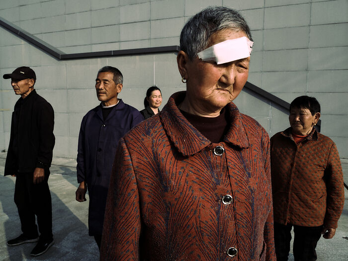 Group portrait with a woman wearing an eye patch, reflecting resilience and human spirit
