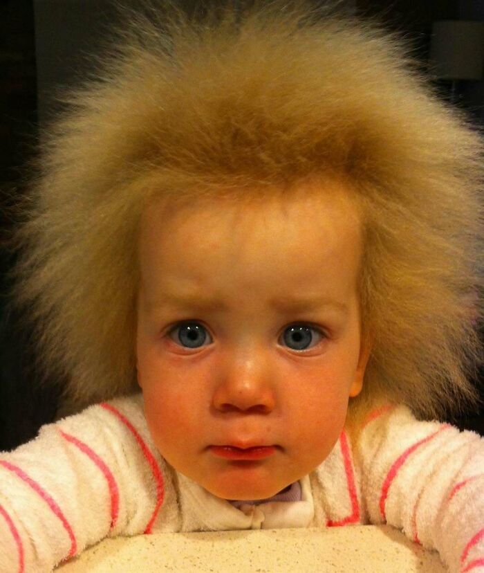 Toddler with distinctive fluffy hair texture and blue eyes showing interesting body quirks