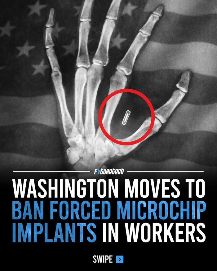 An X-ray of a hand with a microchip implant, highlighting future technology and ethical concerns.