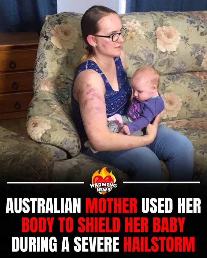Mother with bruised arms holding her baby, both safe after a severe hailstorm, soul-healing image.