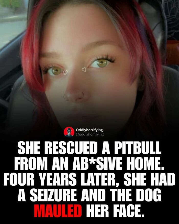 An image of a woman whose face was mauled by a pitbull, part of dark and depressing stories.
