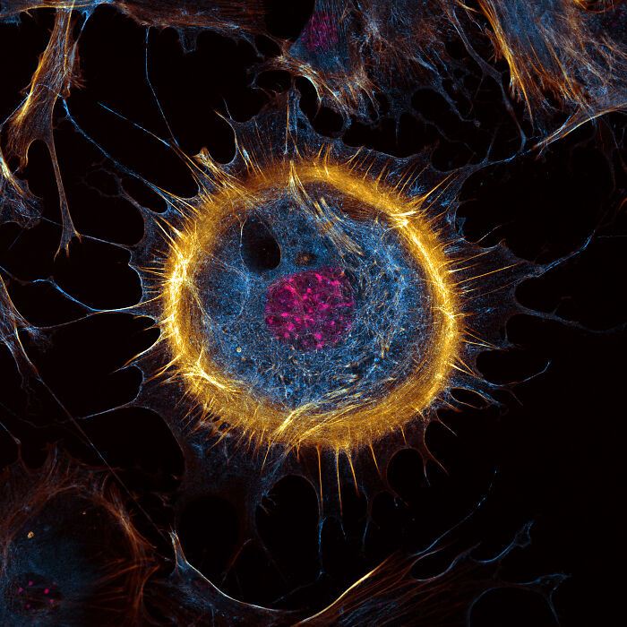 “Mouse Embryonic Fibroblast” By Joe Mckellar