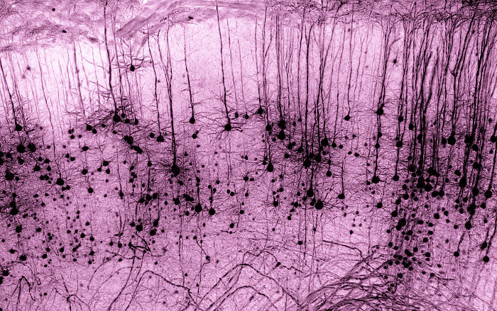 “Gfp-Positive Thy1 Neuron In A Tissue-Cleared Mouse Brain” By Marko Pende