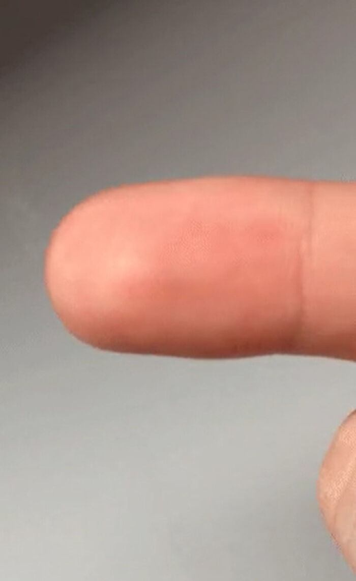 Close-up of fingertip showing skin detail in scientific macro photography