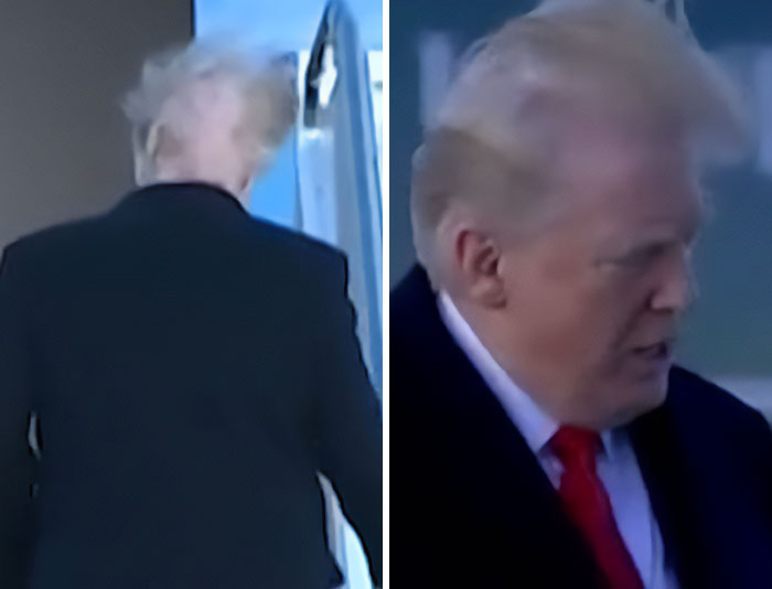 Side and back views of Trump with visible hair-loss and hair treatment