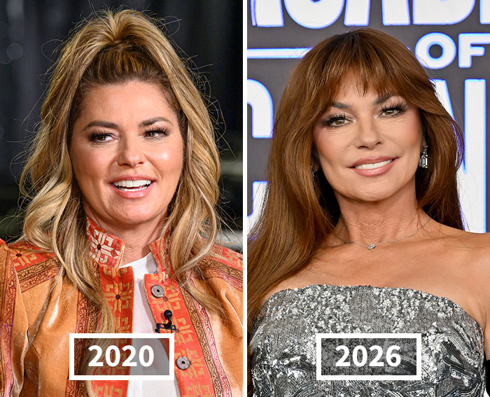 Side-by-side comparison of Shania Twain in 2020 and 2026, highlighting her beauty standards transformation. Side-by-side comparison of Shania Twain in 2020 and 2026, highlighting her beauty standards transformation.