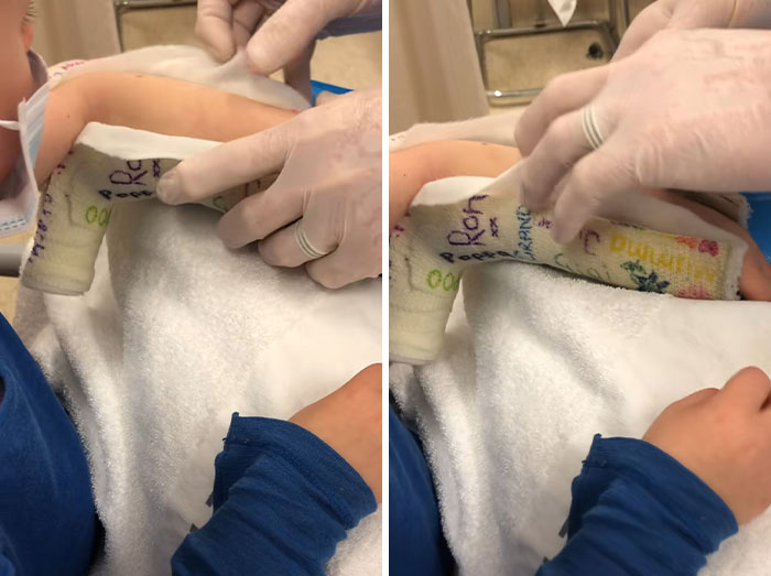 Doctor discovers surprise in boy's plaster cast during removal, showing the cast being cut carefully.