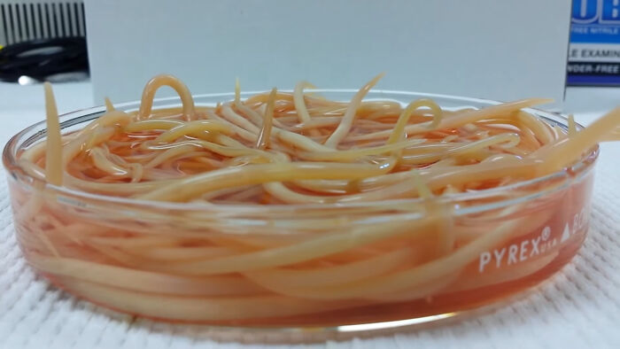 Roundworms in a petri dish, a health trend doctors wish they saw less often, contributing to intense stress and burnout.