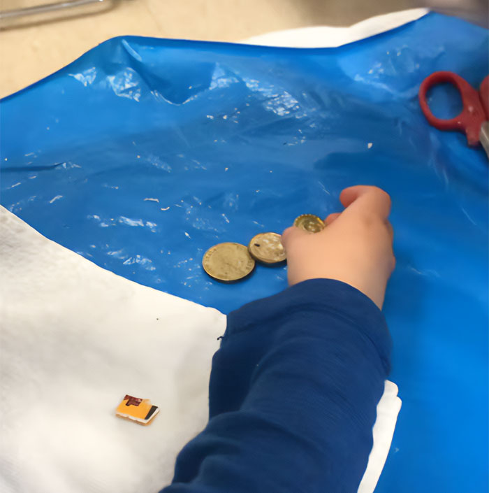A child's hand picking up coins, part of the jaw-dropping surprise found in the boy's plaster cast.