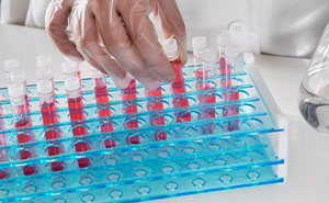 34 Stories About The Shocking Results Of DNA Testing That Created Or Destroyed Families
