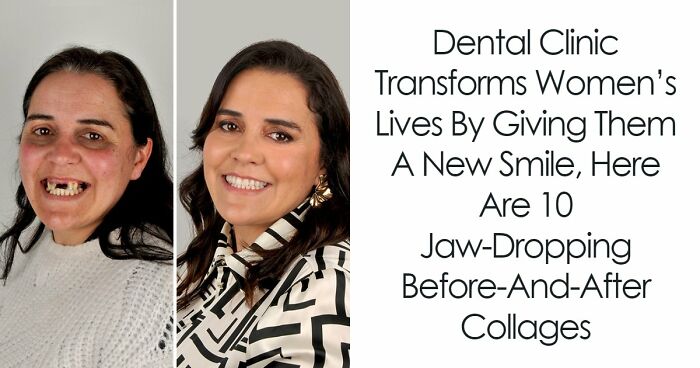 8 Jaw-Dropping Before-And-After Collages Of Women Who Underwent Extensive Smile Makeovers